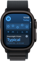 Apple Watch Ultra 3, casing titanium alami, layar skor tidur, perincian dalam diagram lingkaran, skor di tengah, tali jam, Loop Trail biru